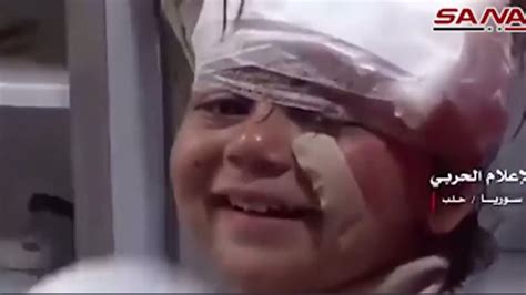 Y­a­r­a­l­ı­ ­S­u­r­i­y­e­l­i­ ­k­ü­ç­ü­k­ ­k­ı­z­ı­n­ ­g­ü­l­ü­m­s­e­m­e­s­i­ ­d­ü­n­y­a­y­ı­ ­s­a­r­s­t­ı­